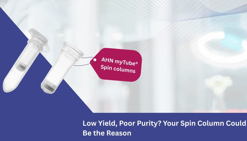 Low Yield, Poor Purity Your Spin Column Could Be the Reason